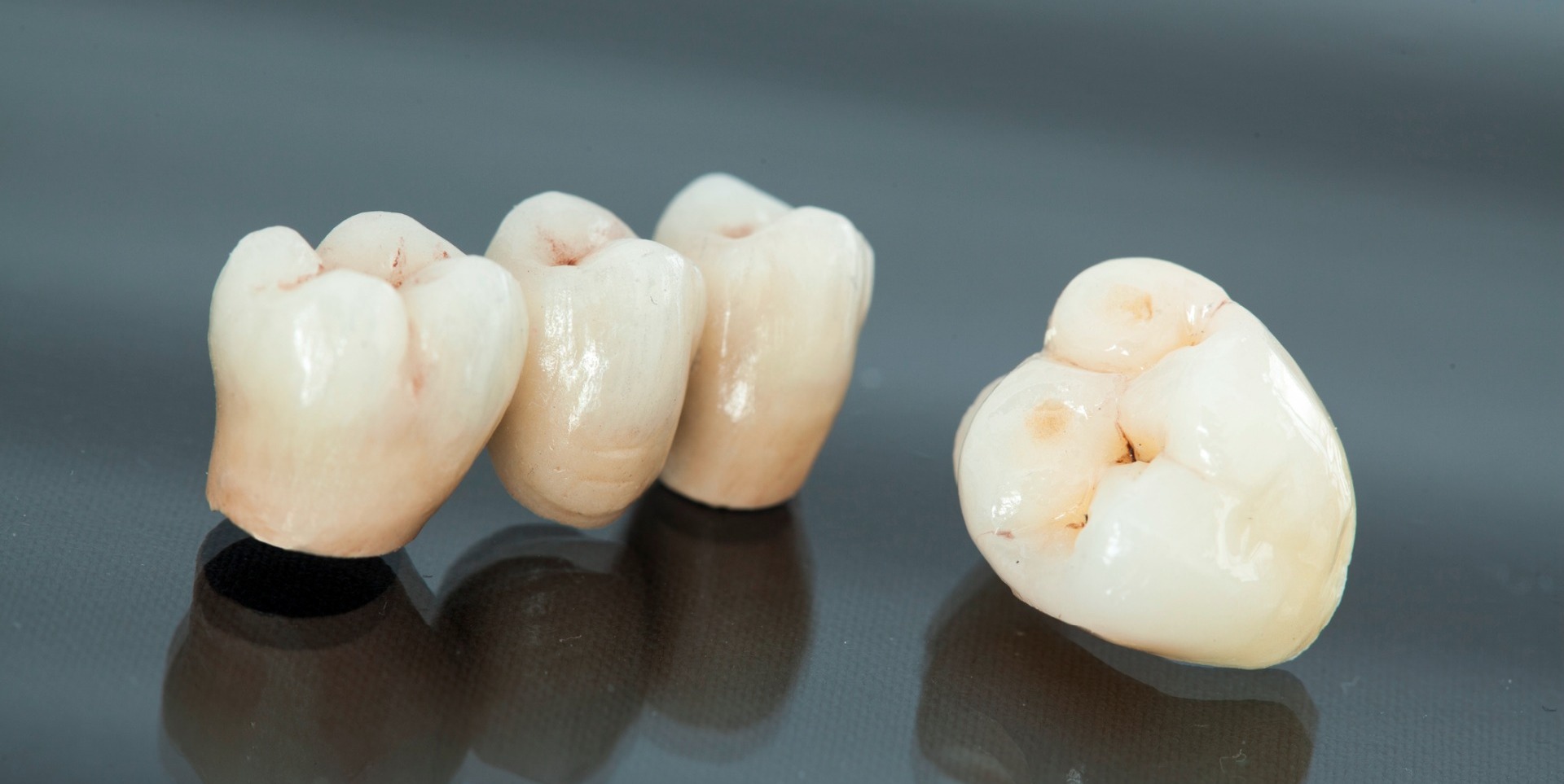 Tooth crown - Reepham Dental practice